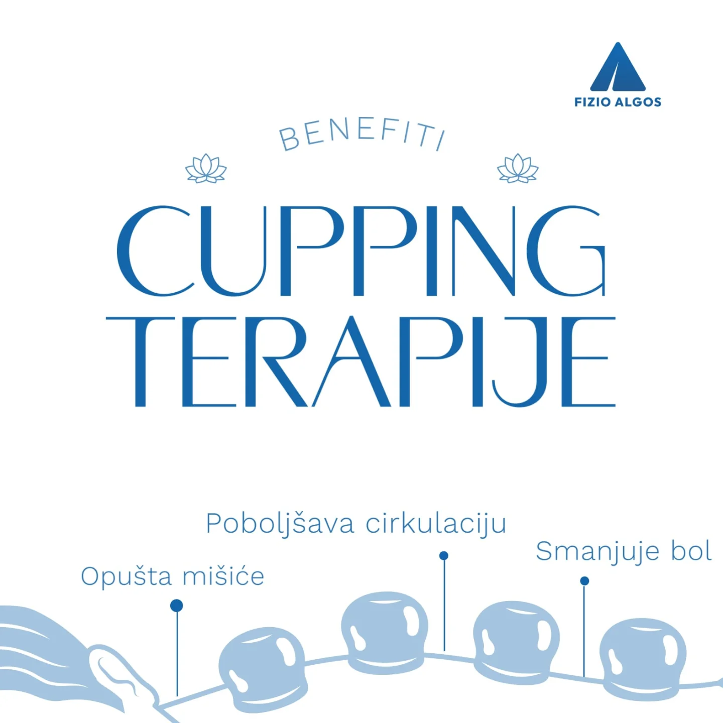 Cupping terapija